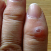 Thumbnail of related posts 098