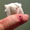 Thumbnail of related posts 179