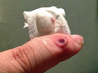 Thumbnail of post image 153